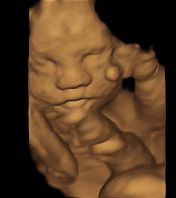 3d/4d Scanning