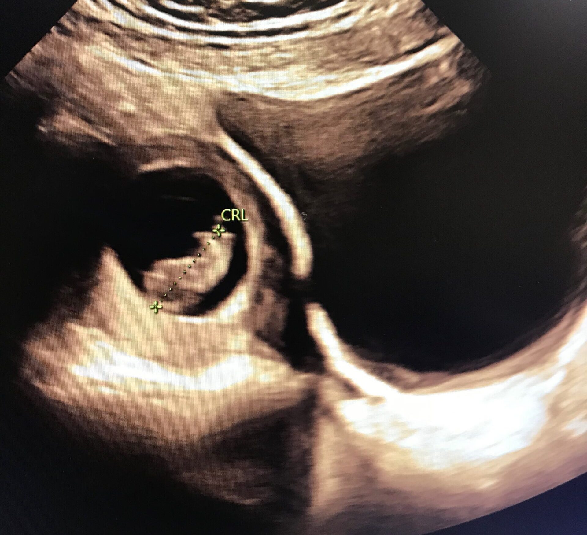 Tidlid scanning